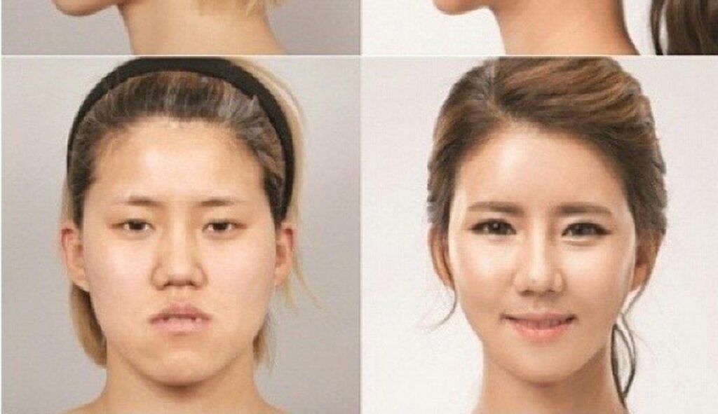 operasi plastik di korea